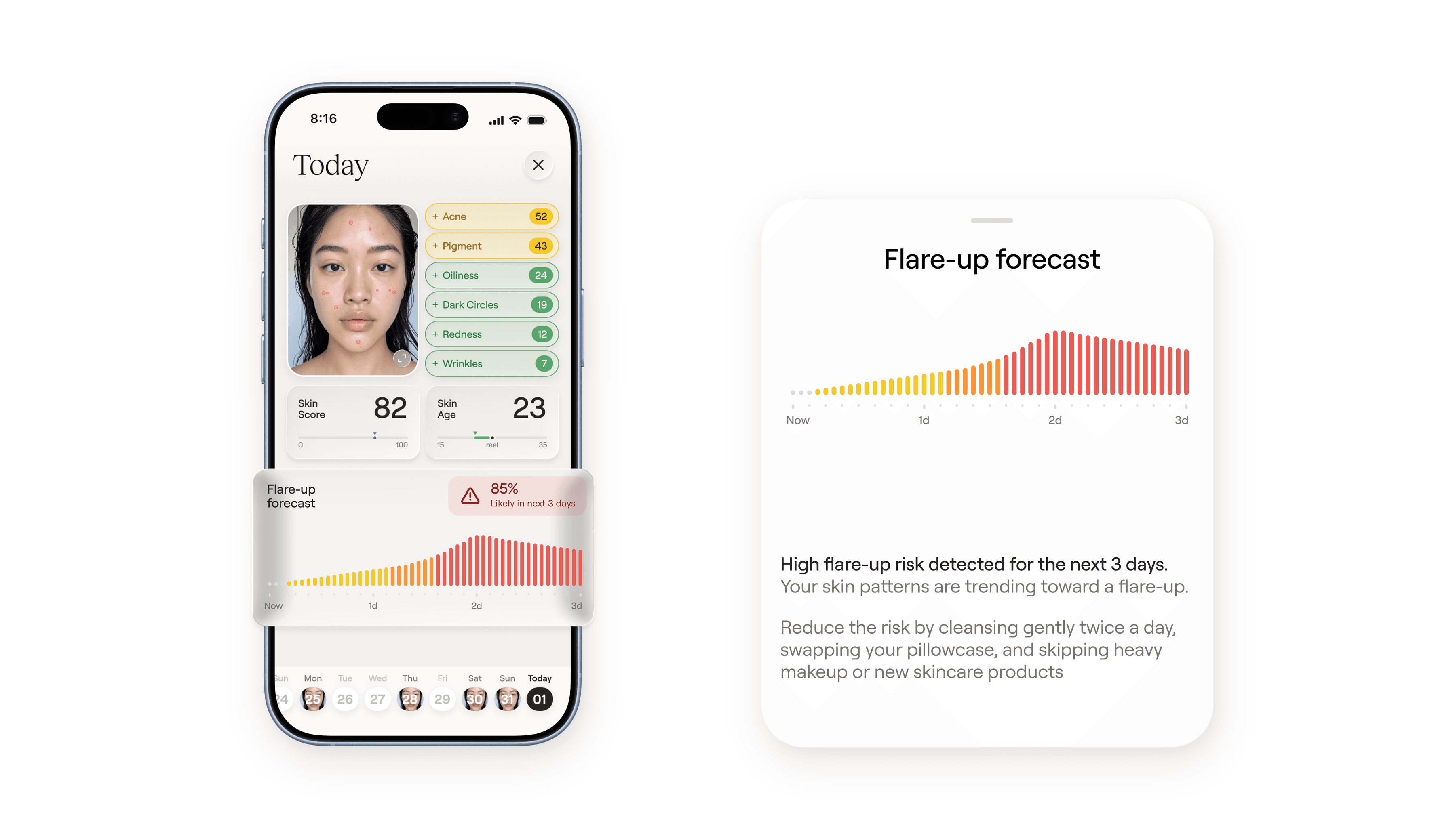 Nolla Derm app on iPhone with a flare-up forecast and expanded forecast details.