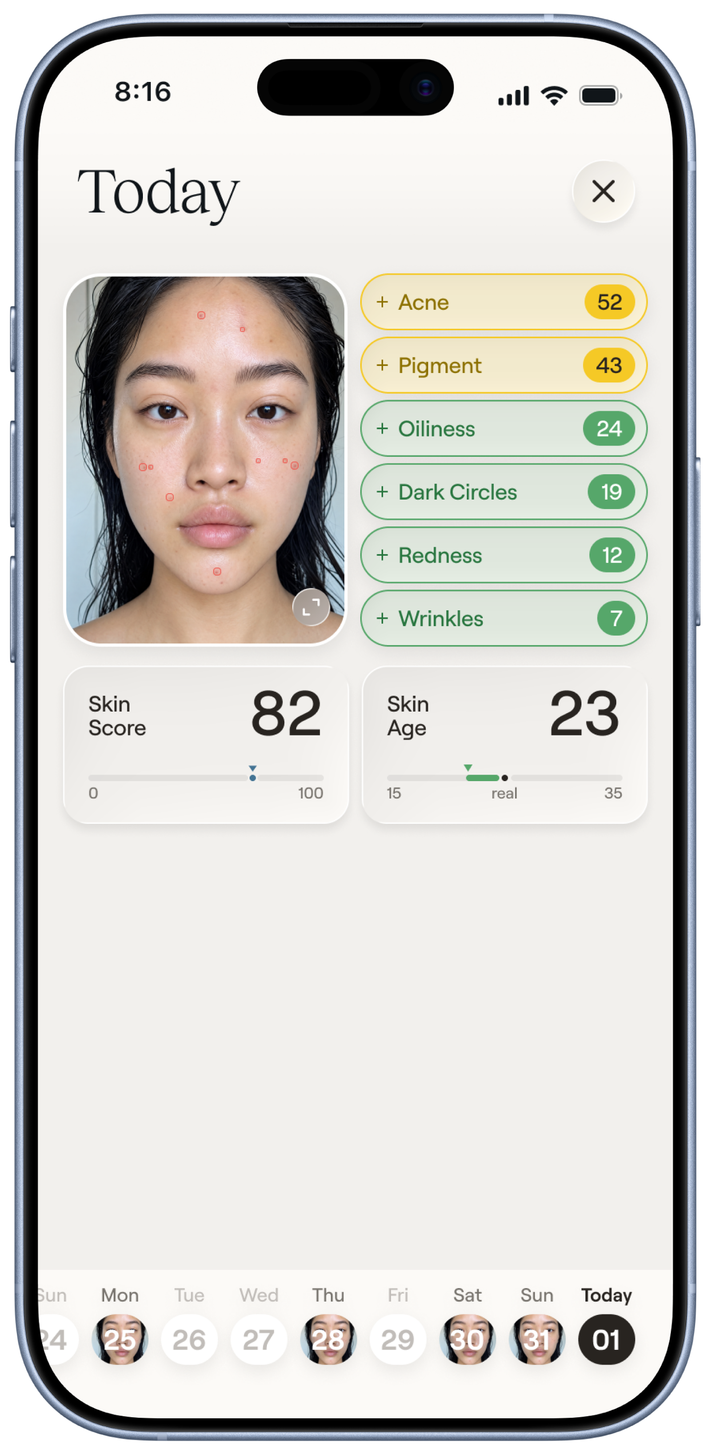 Nolla Derm app on iPhone with skin measurements, scan history, and an example 85% flare-up forecast.